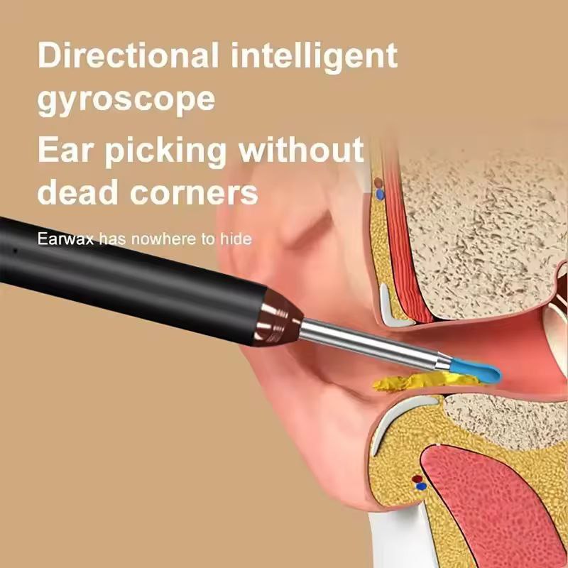 Wireless HD Visual Ear Cleaning Endoscope – Smart Ear Wax Removal Tool with LED Light